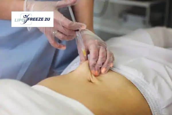 Fat Dissolving Injections Redhill & Weight loss medication