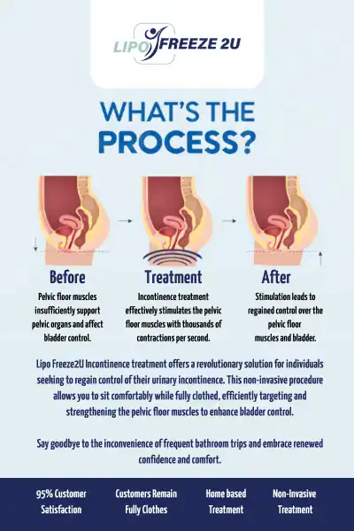 Diagram of how incontinence treatment Redhill works.