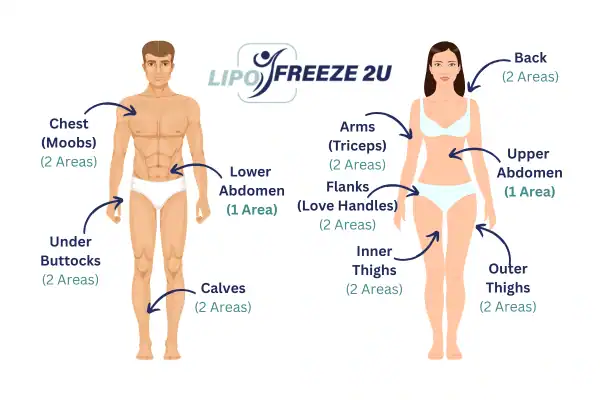 Areas you can have fat freezing treatment Redhill