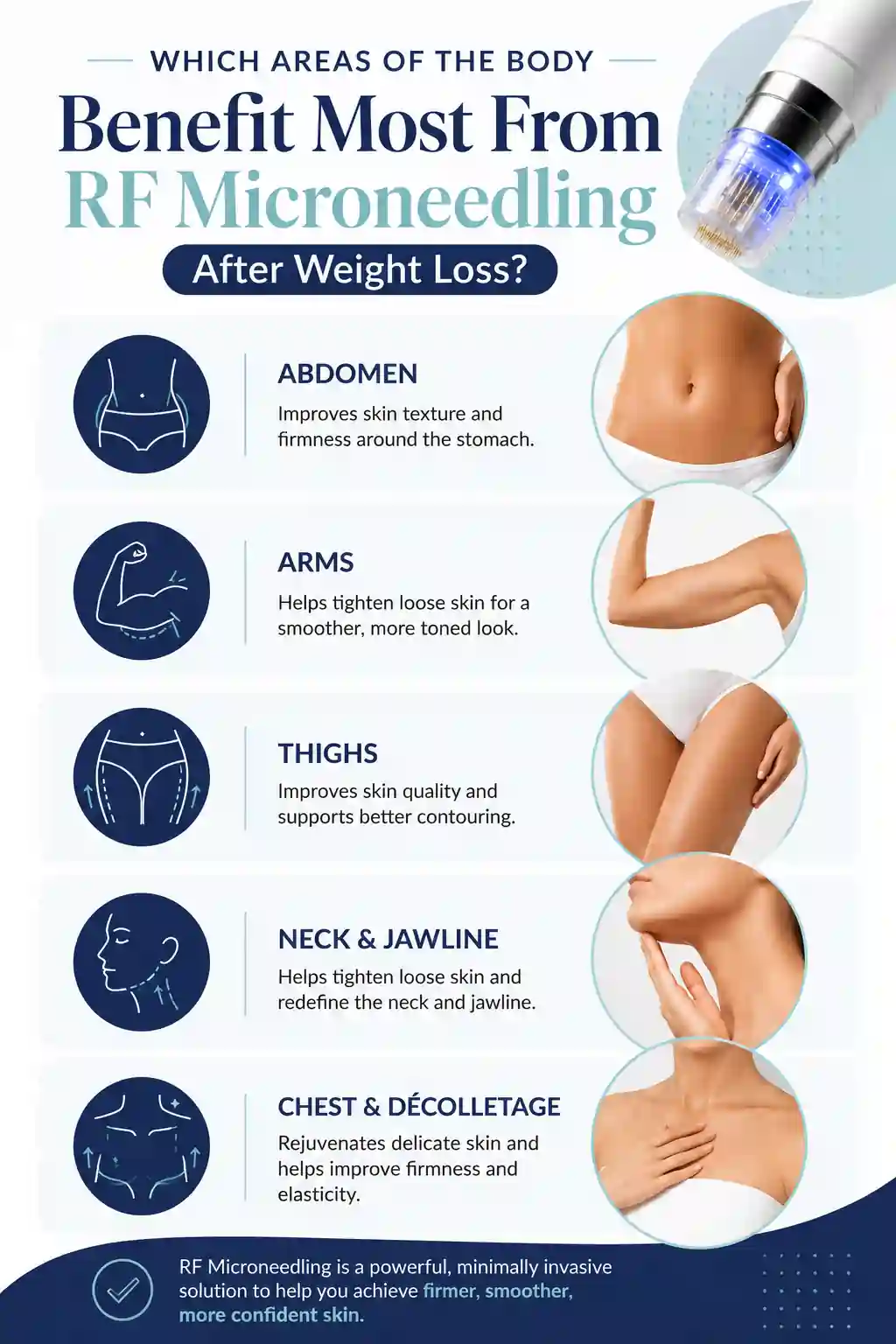 Which Areas of the Body Benefit Most From RF Microneedling After Weight Loss Redhill